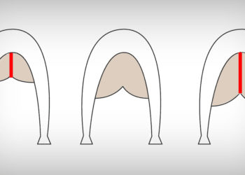 UDDER Conformation: What do you need to know?